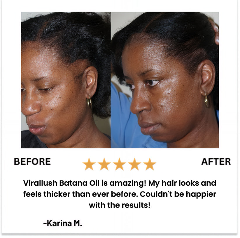 Batana Oil Travel Size