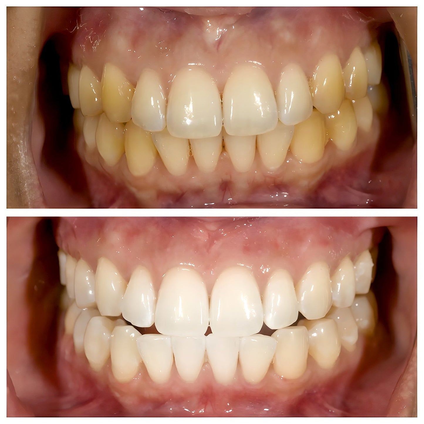 Viralaluna-ToothPaste