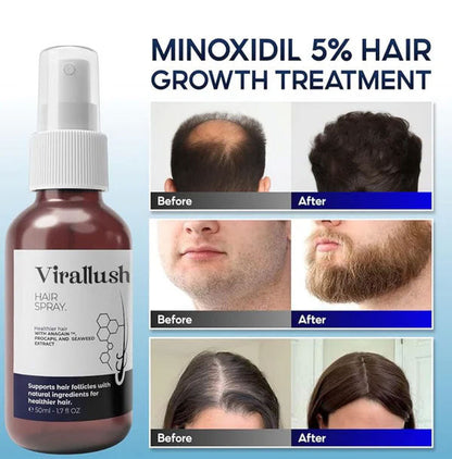 Viralaluna Hair Growth Spray