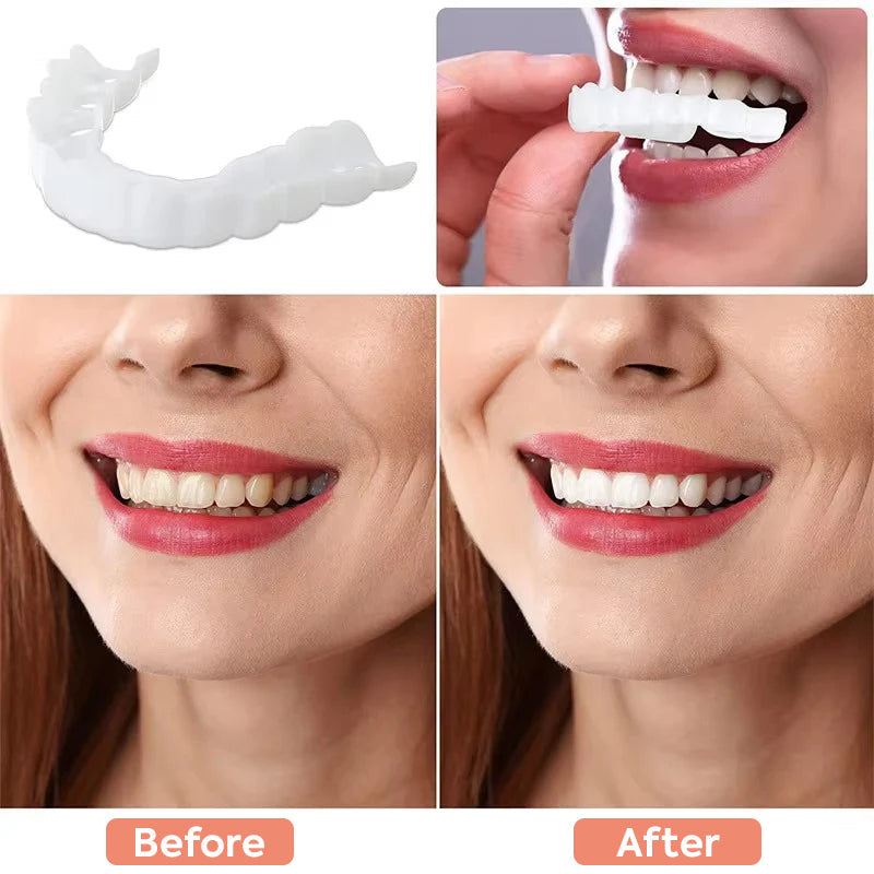 Viralaluna SmileFlex