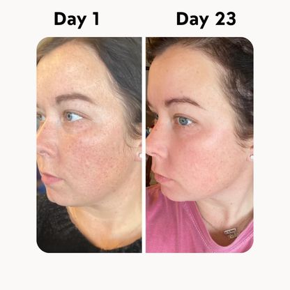 Organic Grass-Fed Beef Tallow Balm With Raw Honey