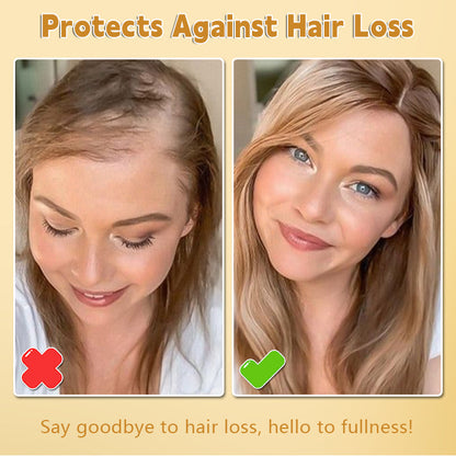 Biotin Hair Growth Essence Spray (New Formula)