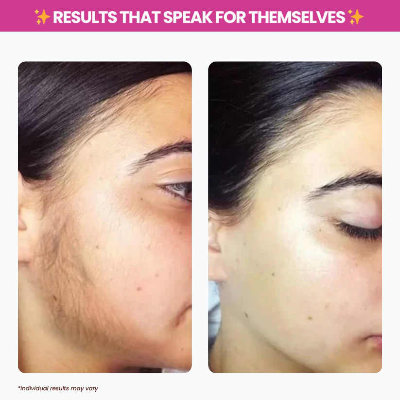 Viralaluna™ Cyperus Rotundus Oil