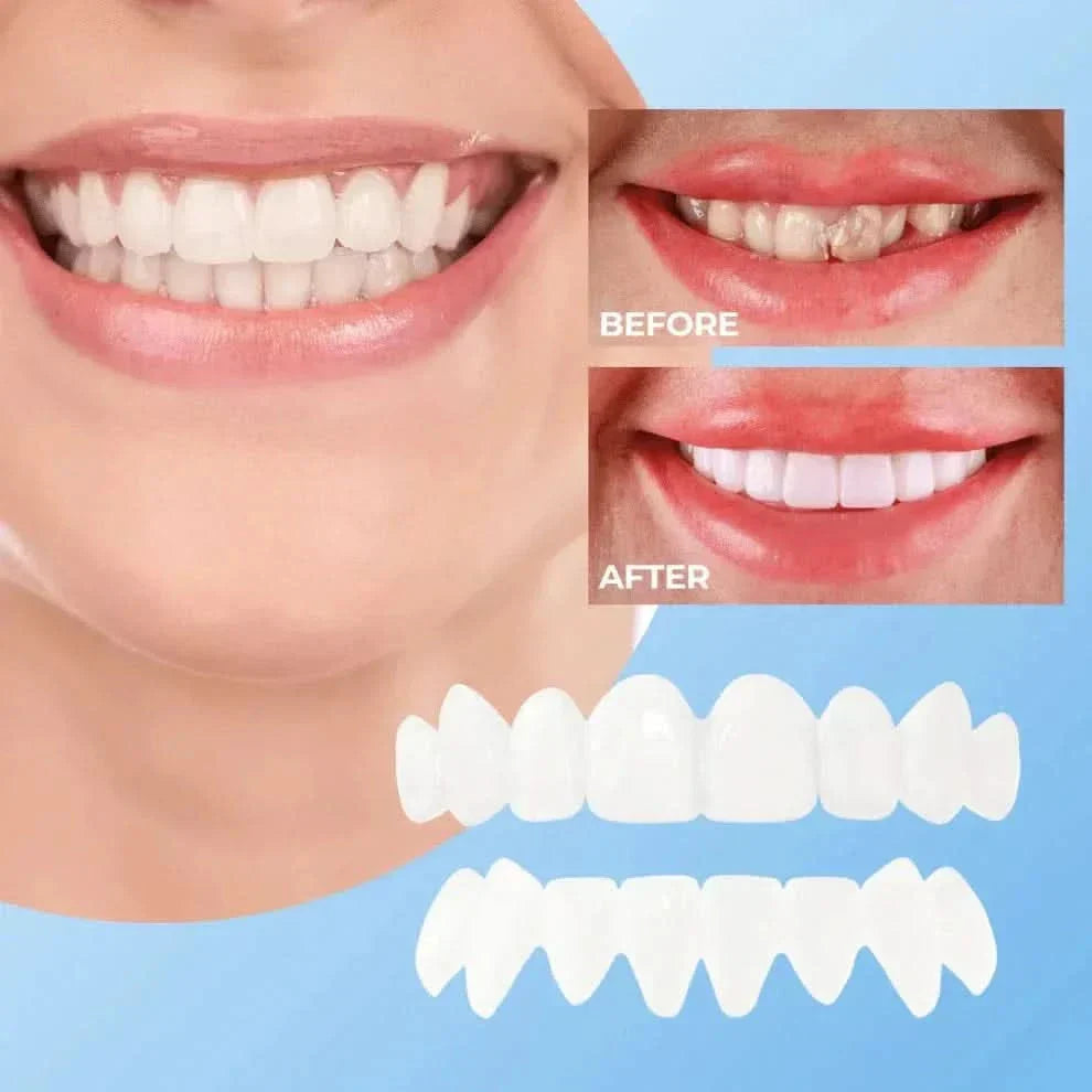 Viralaluna SmileFlex