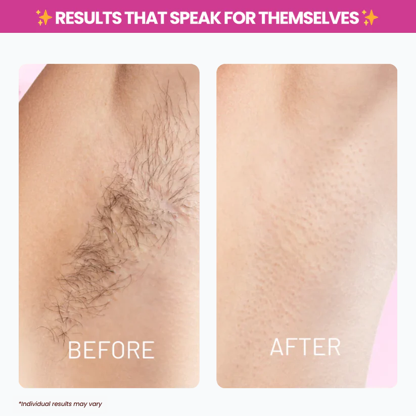 Viralaluna™ Cyperus Rotundus Oil