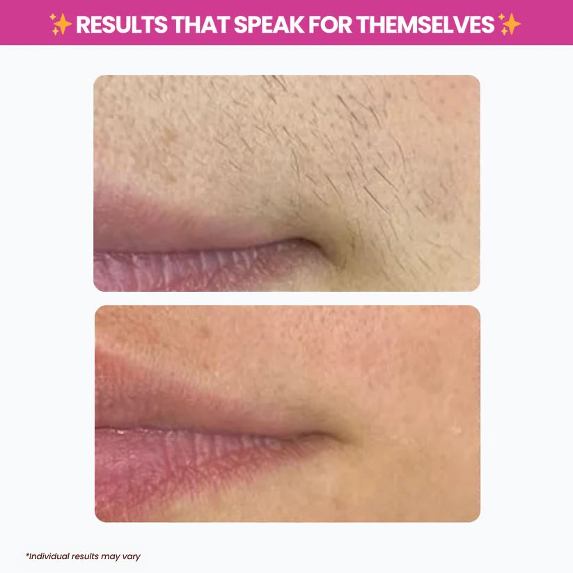 Viralaluna™ Cyperus Rotundus Oil