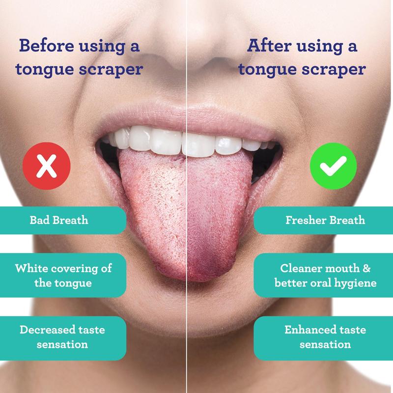 U Shaped Stainless Steel Tongue Scraper (2-Pack) Oral Case
