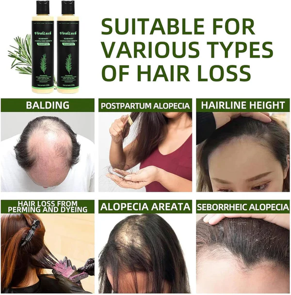 Viralaluna Rosemary Shampoo
