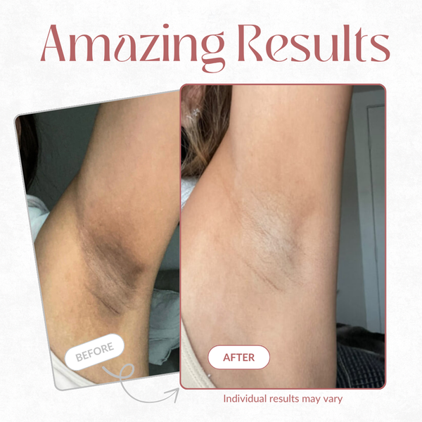 Viralaluna Peel Shot - Kojic + Turmeric Body Peel Spray