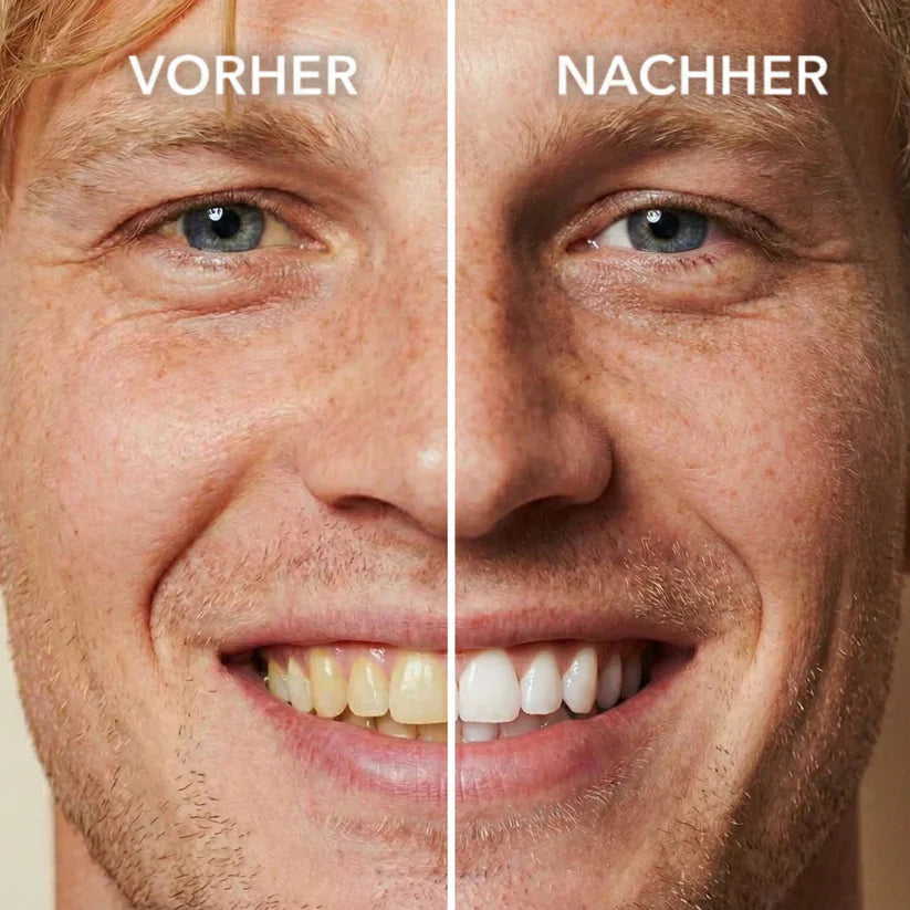 Viralaluna™ Tooth Polish