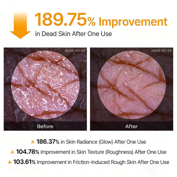 Viralaluna Peel Shot - Kojic + Turmeric Body Peel Spray