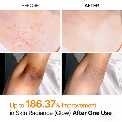 Viralaluna Peel Shot - Kojic + Turmeric Body Peel Spray