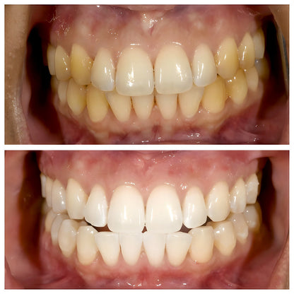 Viralaluna-ToothPaste