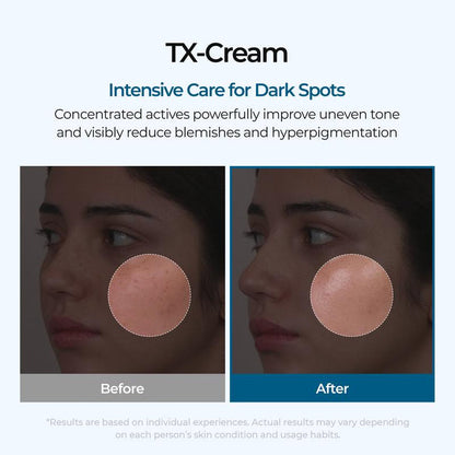 TX - Cream