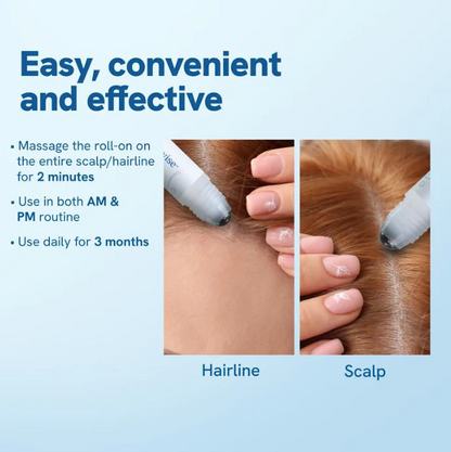 Advanced Hair Growth Roll-On Serum